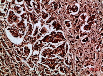 HDGF rabbit pAb Antibody