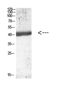 IL12B p40 antibody