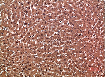 GSTA1 antibody