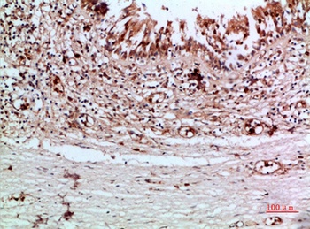 Thyroglobulin antibody