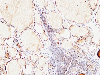 Thyroglobulin rabbit pAb Antibody