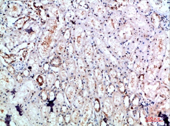 DLEU7 antibody