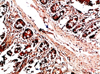 HLA-DQA1 rabbit pAb