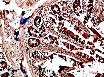 HLA-DQA1 rabbit pAb Antibody
