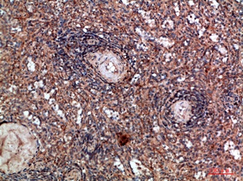 HLA-DQA1 rabbit pAb Antibody
