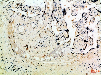 Ob antibody