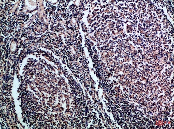 CD1A/B rabbit pAb