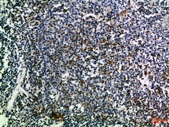 CD274 rabbit pAb Antibody
