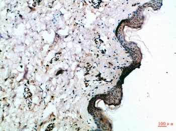 Frizzled-4 antibody