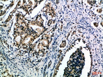 IL15 antibody