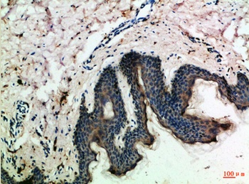 MCP-3 antibody