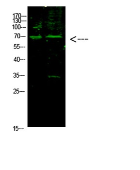 E2F-1 (Acetyl-K117) antibody