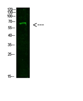 NUT antibody