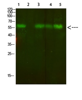 AVP Receptor V2 antibody