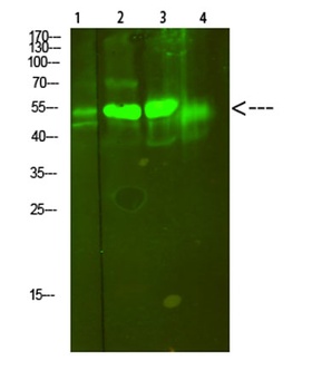 V-ATPase S1 rabbit pAb Antibody