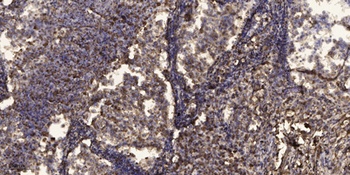 PBEF rabbit pAb Antibody