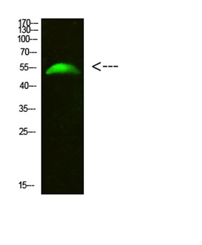 GCM2 antibody