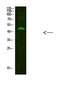 NMUR2 antibody