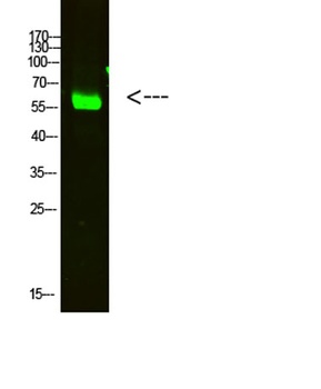 OASL rabbit pAb Antibody