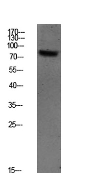 SYK (Phospho-Tyr348) Rabbit pAb Antibody