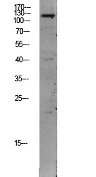 TIE2 antibody