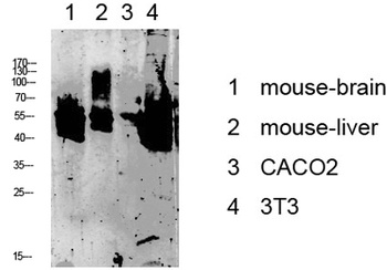 Keratin 8 rabbit pAb Antibody