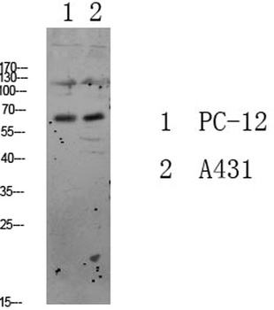FKHRL1 rabbit pAb Antibody