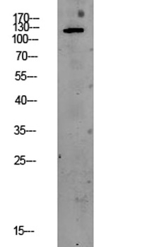 PEK/PERK rabbit pAb Antibody