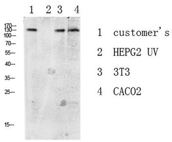 DDR1 Rabbit pAb Antibody