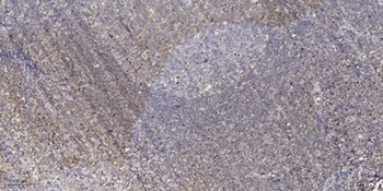 TIF-IA rabbit pAb Antibody