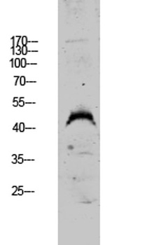 DUSP4 rabbit pAb Antibody