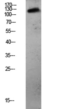 CDH3 rabbit pAb