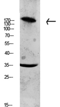 Collagen XI α1 rabbit pAb