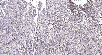 PLD4 rabbit pAb Antibody