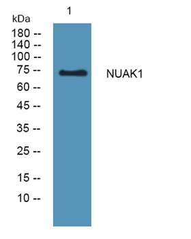 NUAK1 rabbit pAb Antibody