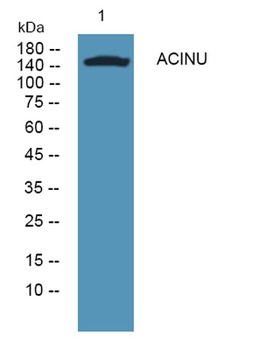 ACINU rabbit pAb Antibody
