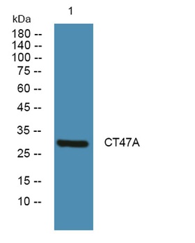 CT47A antibody