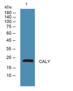 CALY antibody