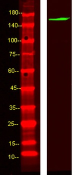 ABCBB rabbit pAb Antibody
