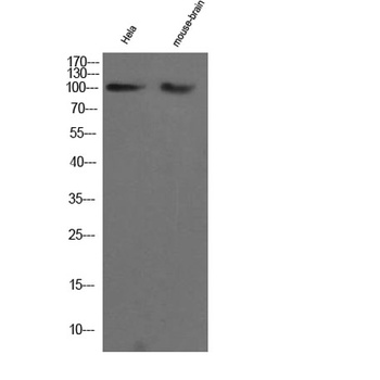 CHERP antibody