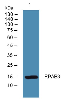 R3 antibody