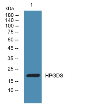 HPGDS rabbit pAb