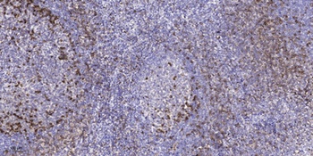 LRBA antibody