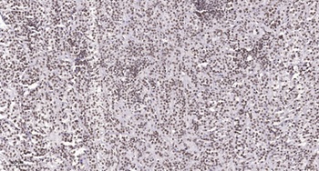 NAV3 antibody