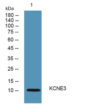 KCNE3 rabbit pAb
