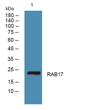 RAB17 rabbit pAb Antibody