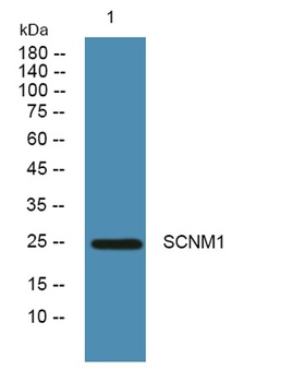 SCNM1 antibody