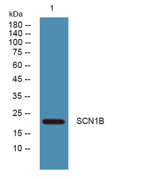 SCN1B rabbit pAb