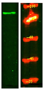 SL9A2 rabbit pAb Antibody