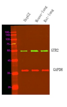 GTR2 rabbit pAb Antibody